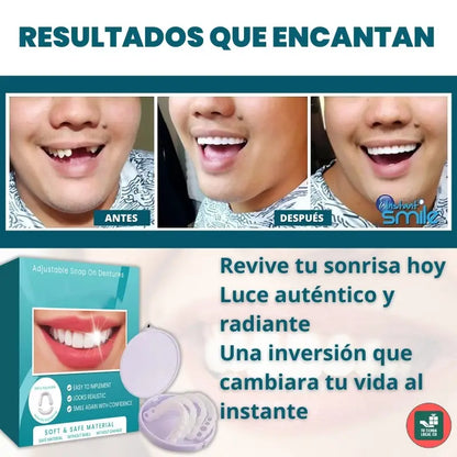CARILLAS DENTALES GG SNAP ON DENTURE UN CAMBIO QUE TRANSFORMA TU VIDA AL INSTANTE